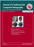 J CARDIOVASC COMPUT 心血管计算机断层扫描杂志