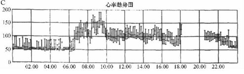 图1 C. 24 h Holter示清醒状态下窦性心率突然加快，持续一整天，仔细回顾分析ECG记录，符合窦性心动过速的诊断（点击看大图）。