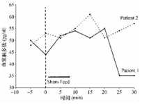 图2 患者1和2的胰多肽对假饲法的反应曲线（点击看大图）